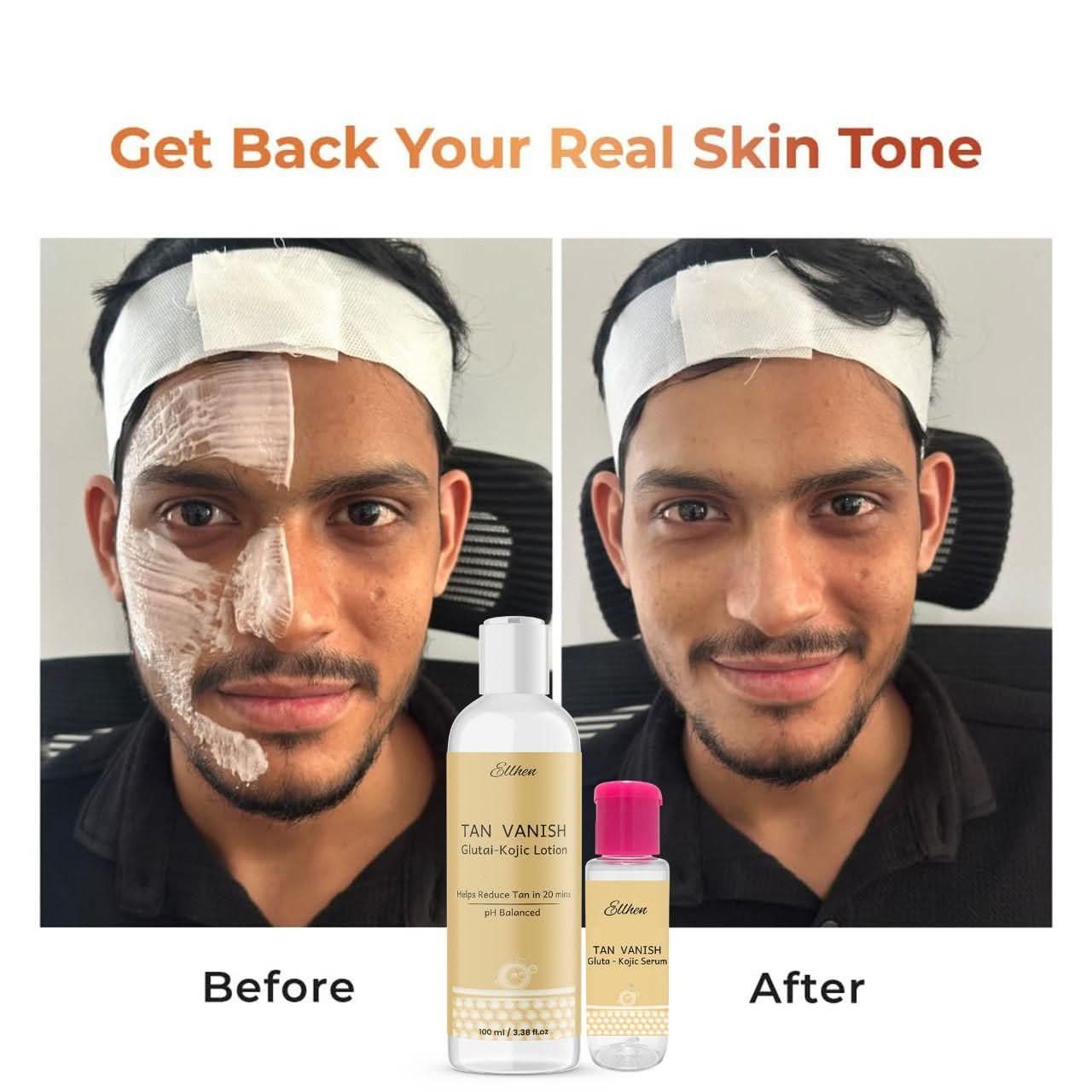 Tan Vanish Glutai Kojic Lotion and Gluta Kojic Serum 100 ml - Canis couture