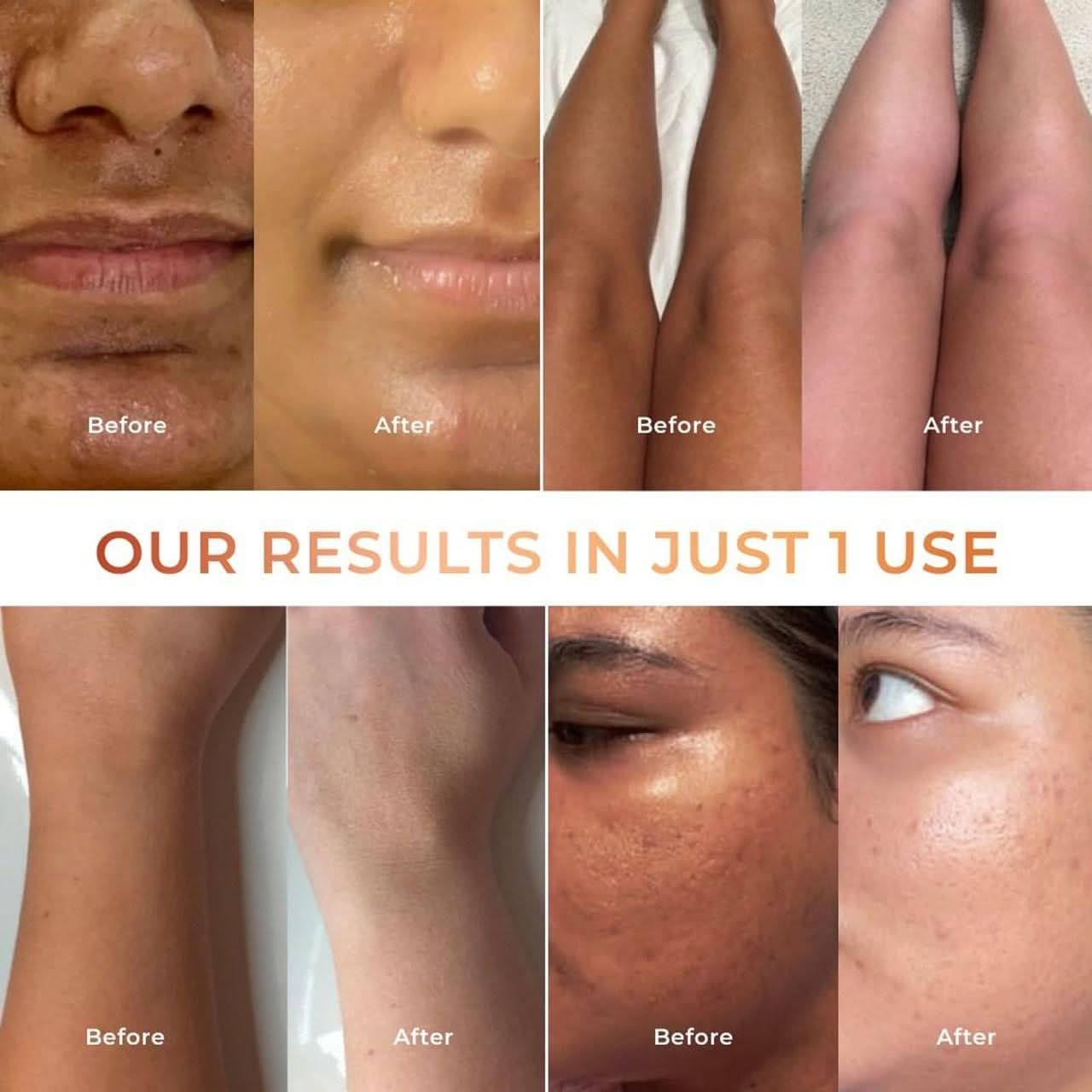 Tan Vanish Glutai Kojic Lotion and Gluta Kojic Serum 100 ml - Canis couture